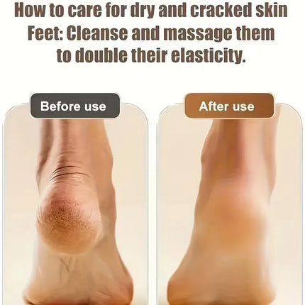 Electric Foot File Callus Remover Remover Rechargeable Pedicure Tool with 3 Grinding Heads for Dead Hard Cracked Dry Feet Skin