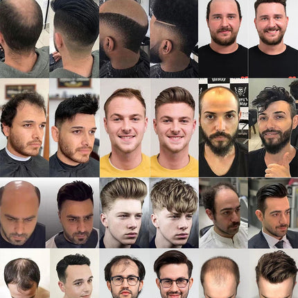 Undetectable Men Toupee All V Loop Super Thin Skin Hair Replacement System for Men Natural Hairline Wig