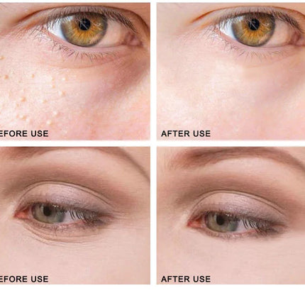 ARTISCARE Eye Cream for Dark Circles Removal Wrinkles Puffiness Eye Bags Moisturizing Serum Eye Care
