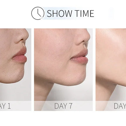 LAIKOU Nicotinamide Serum Whitening Face Serum Ampoule Essence Moisturizing Anti-Aging Anti-Wrinkle Shrink Pores Skin Care Serum