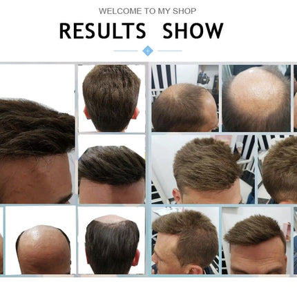 Human Hair Men's Wigs Skin PU Toupee Men Capillary Prosthesis Hair Unit Replacement System Hair Pieces Wig For Men