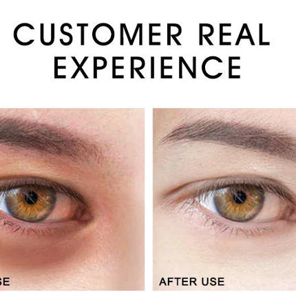 ARTISCARE Eye Cream for Dark Circles Removal Wrinkles Puffiness Eye Bags Moisturizing Serum Eye Care