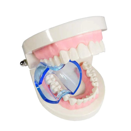 10pcs Dentistry Mouth Opener Dental Orthodontic Lip Cheek Retractor Expander dental products abrebocas dentales