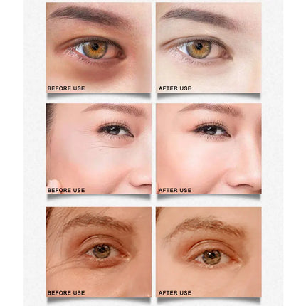 ARTISCARE Gold Osmanthus Eye Mask for Dark Circles Hyaluronic Acid Moisturizing Eye Patches Eye Care
