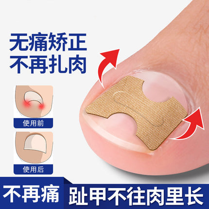 Cross-Border Correction Artifact, Special Nail Patch for Long Toenails in the Flesh, Nail Groove Ingrown Nail Corrector, Toenail Tool