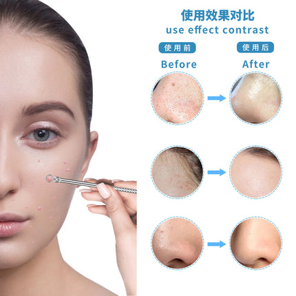 Stainless Steel Acne Clip Cell Clip Acne Needle Acne Squeeze Blackhead Whitehead Beauty Needle Multi-Piece Set Tool