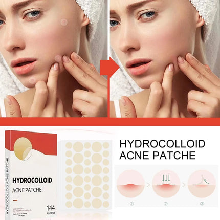 144pcs Invisible Removal Pimple Anti-Acne Hydrocolloid Patches Spots Marks Concealer Repair Sticker Waterproof Beauty-health