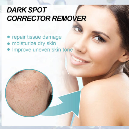 Retinol Whitening And Spot Removing Cream Softens Fine Lines & Wrinkles Repairs Skin Barriers Moisturizing And Brightening Face