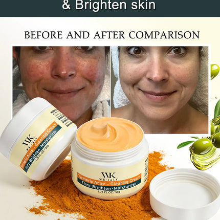 WK JALY Acne Clearing Brighten Turmeric Face Cream, Remove Spots, Pigmentation, Improve Dull Skin, With Niacinamide, Aloe Vera