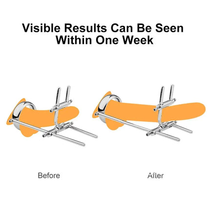 Male Enlarger Stretcher Tension Traction Correction Men Penis Extender Enlarger Device Bending 18+ Toy Sex Penis for Clamp Metal