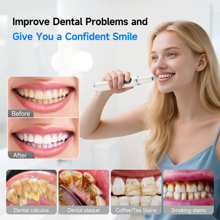 CURVY MOON T6 Electric Sonic Dental Calculus Scaler Oral Teeth Tartar Remover Plaque Stains Cleaner Removal Teeth Whitening