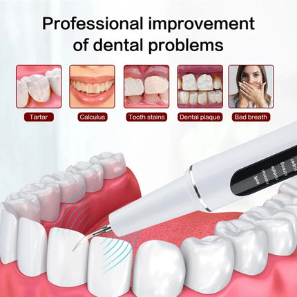 XIAOMI MIJIA Ultrasonic Dental Scaler 2.8M/min High Frequency Vibrating Teeth Cleaner Plaque Calculus Tartar Stains Remover