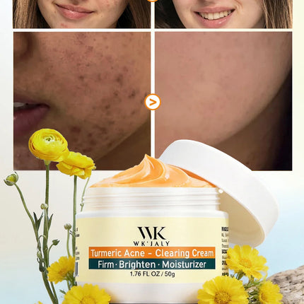 WK JALY Acne Clearing Brighten Turmeric Face Cream, Remove Spots, Pigmentation, Improve Dull Skin, With Niacinamide, Aloe Vera