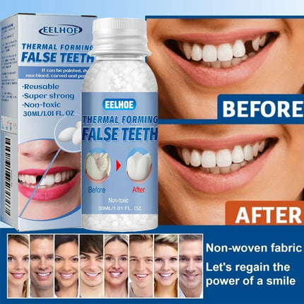 Temporary Tooth Repair Beads | Food Grade Dental Filling Material for Missing Broken Teeth, Denture Adhesive Solid Glue