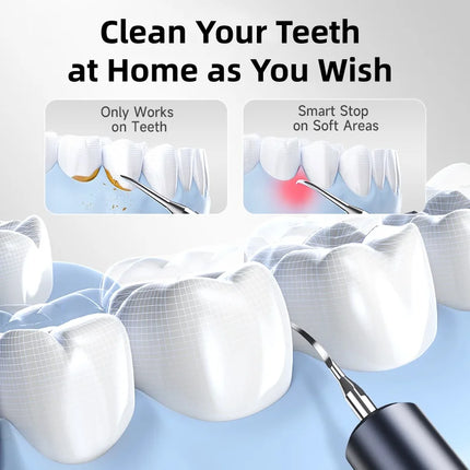 5 Modes Electric Cleaner Ultrasonic Dental Scaler For Teeth Tartar Eliminator Waterproof IPX6 Home Appliance Teeth Cleaning Tool