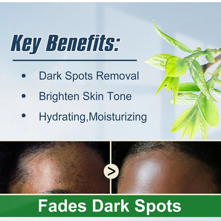 WK JALY Whitening, Black Spots Removal Serum, With Niacinamide, Arbutin, Remove Melanin, Freckles, Even Skin Tone, for All Skin