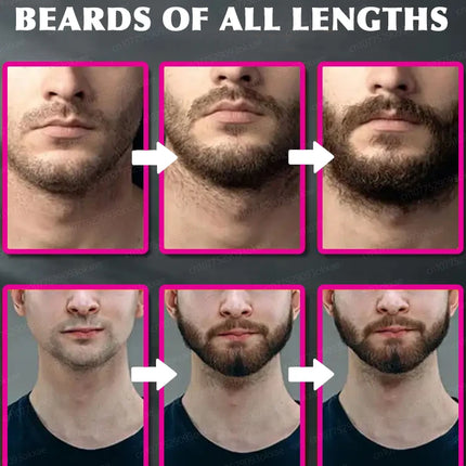 Beard growth essence. It helps your beard grow quickly, and is a must-have for mature men. It makes you look more manly and is e