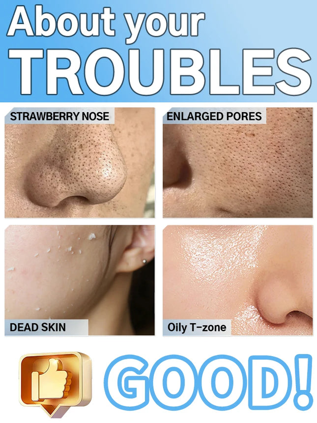 Deep vibrating facial cleansing scraper/ultrasonic facial cleansing device, exfoliating blackhead remover/facial massager