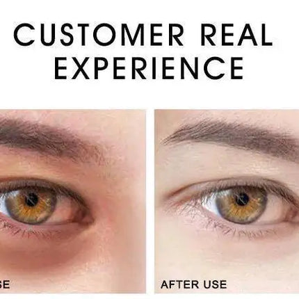Eye Serum Roller Massager & Gold Eye Cream Eye Care 2pcs/set Dark Circles Fade Puffiness Moisturizing