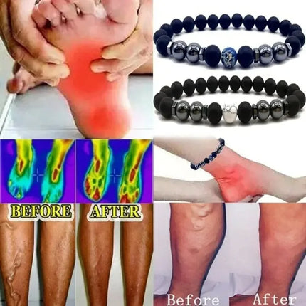 Anti-Swelling Black Obsidian Anklet Bracelet Treatment  Adjustable Weight Loss Magnetic Therapy Magnet Anklet Bracelet Women Men