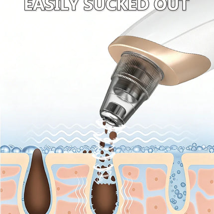 Blackhead Remover pimples and blackheads vacuum pores removal  facial skin cleansing device For Deep cleaning home