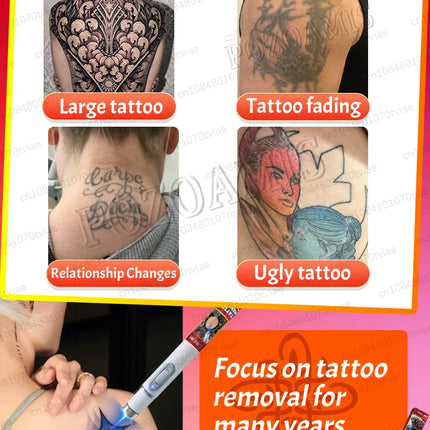 Remove old tattoos with a single click.