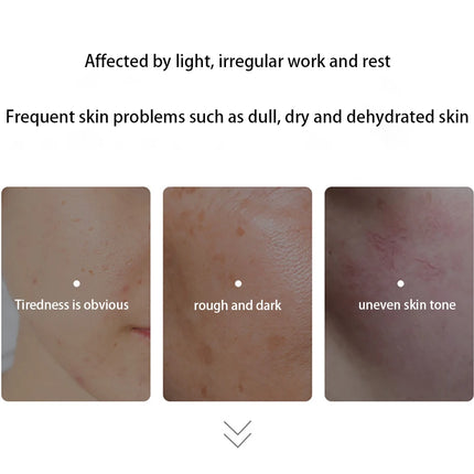 Specialized in repairing Soothing sensitive skin barriers face Lotion Moisturizing face Toner Fade red blood Essence skin care