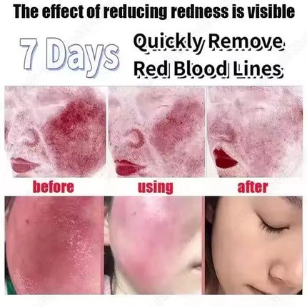 Facial Redness Repair Cream Improve Sensitive Skin Dryness Moisturizer Hydrating Sooth Lotion Removal Rosacea Korean Cosmetics