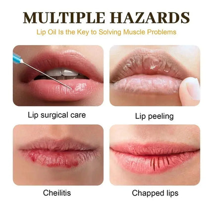 Fast Lightening Pink Mouth Lips Serum Permanent Bleaching Remove Dark Smoke Lips Lip Balm Moisturize Gloss Lipstick Lip Mask