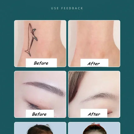 New Hot Product Arrival Eyebrow Washing Machine 1064nm & 532nm Switched Machine Eyebrow Pigment Wrinkle Removal beaut Products