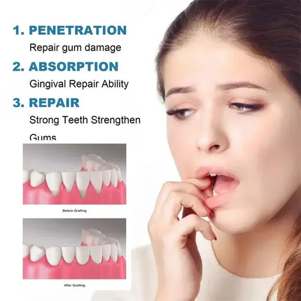Kit de Limpieza Profunda para Dientes – Blanqueamiento Rápido y Eliminación de Placa