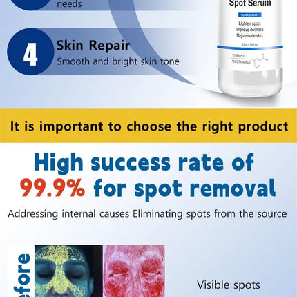 2025 Bestselling Facial Spot-Fading Cream, Effectively Removes Facial Dark Spots