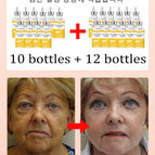 Buy 10 get 12 free