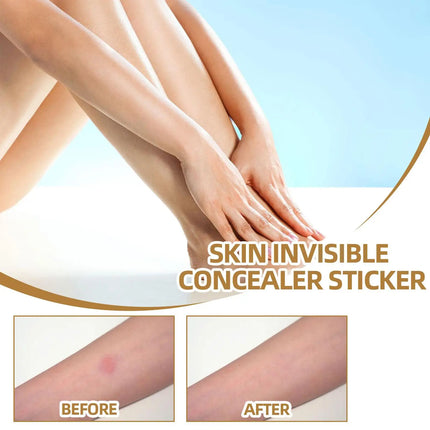 Skin concealing patch-waterproof cover for scars, tattoos, acne marks, birthmarks-natural looking, breathable, reusable