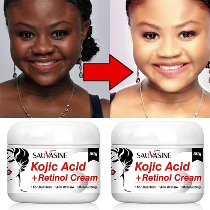 Kojic Acid Cream Remove Pigment Melanin Whitening Remove Dark Spots Cream Nourishing & Resurfacing Fade Skin Care Face Cream
