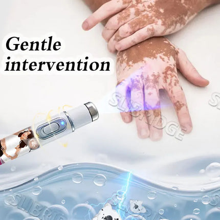 Vitiligo Treatment Device 2nd Upgraded Version⸴Vitiligo Treatment⸴Fast
