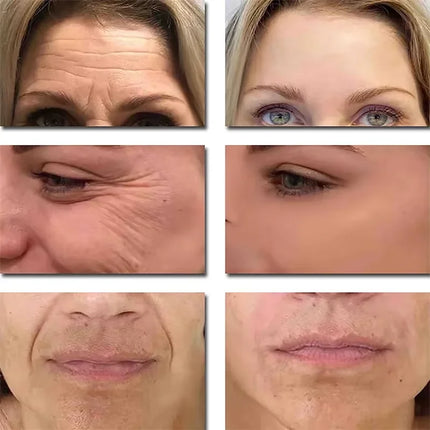 Seoul 1988 2% Retinal Anti Aging Wrinkle Serum Ginseng Facial Essence Firming Pores Brightening Face Moisturizer Korean Skincare