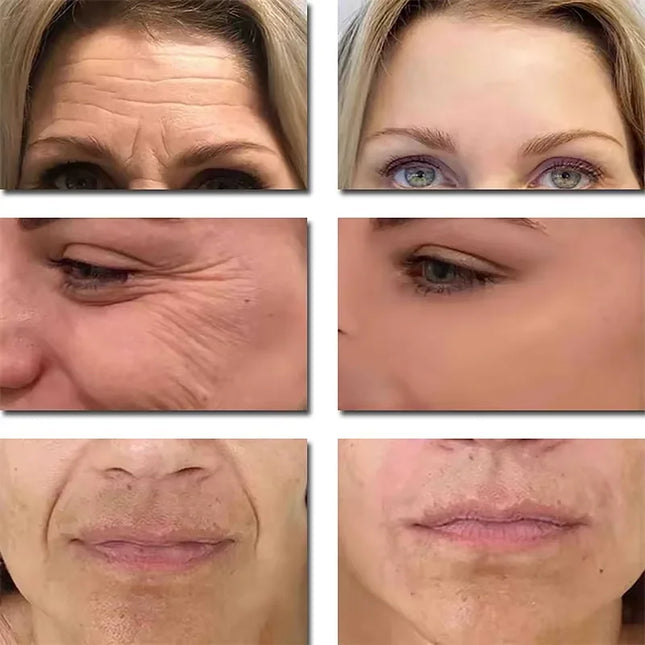 Seoul 1988 2% Retinal Anti-Aging Wrinkle Serum Ginseng Facial Essence Firming Pores Brightening Face Moisturizer Korean Skincare