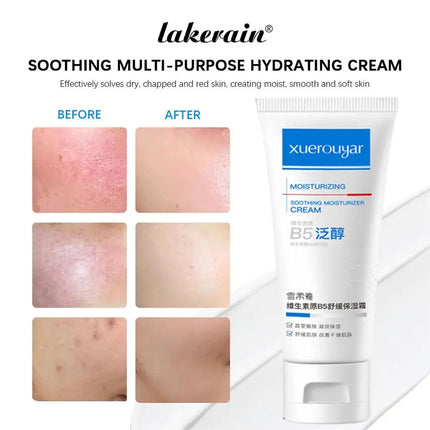 B5 Faded Facial Redness Cream Instant Spider Vein Remove Sensitive Skin Sooth Anti Redness Rosacea Treat Lotion Korean Cosmetic