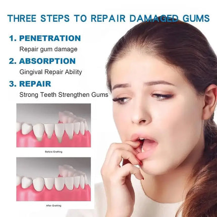Rapid Repair Gums Gel Effectively Relieve Tooth Allergy Dental Caries Tooth Cleaning Toothpaste Relieve Tooth Damage Serum 665*