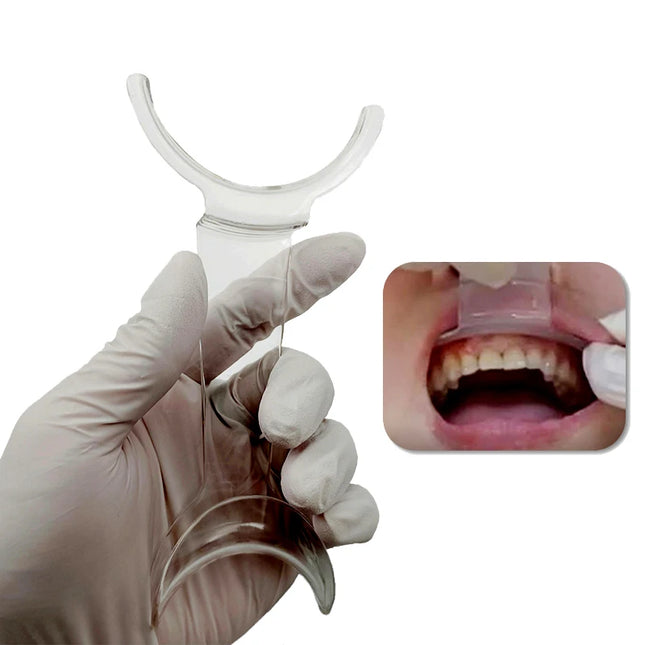 Dental Mouth Openers Lip Retractor Intraoral Cheek Upper Lower Lip Retractor Orthodontic Dentist Tools