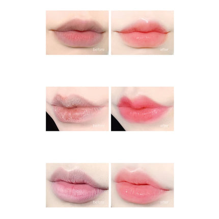 15g Remove Dark Lip Balm Lip Essence Cream Lighten Lip Lines Whitening Moisturizing Brightening Serum Lip Care Product Women Men