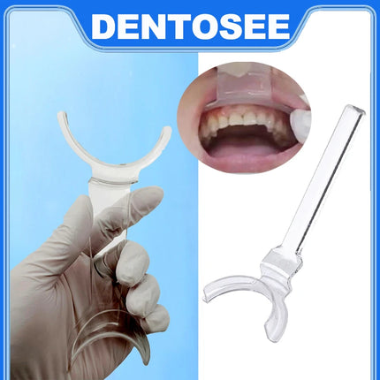 Dental Mouths Openers Lip Retractor Intraoral Cheek Upper Lower Lip Retractor Orthodontic Dentist Tools