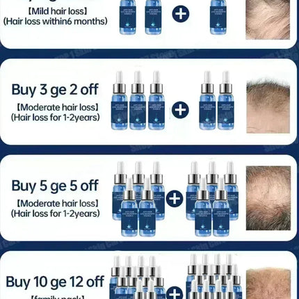 98% of Buyers Buy Again! Hair Care Essential Oils for Thick Hair