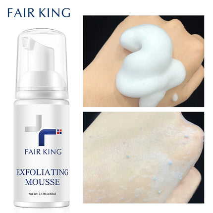 Exfoliating Mousse Improves Skin Texture Gentle Cleansing Makeup Dust Improves Enlarged Pores Oil-control Rosemary Cosmetics