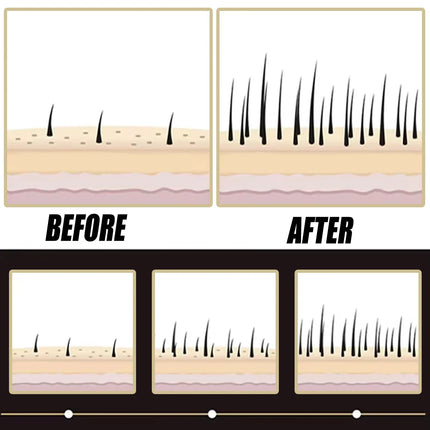 2026  latest technology new products Anti-hair Loss Essence Promotes Hair Growth and Improves The Scalp Environment