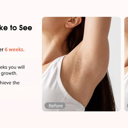 IPL Devices Hair Removal Laser 17J 999900 Light Pulses HR/SC/RA 9 Levels Whole Body Painless Hair Removal Home Use For Men Women