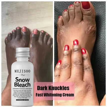 Fast Whitening Dark Knuckles Brighten Hand Cream Melanin Corrector Moisturizing Intense Stains Remover Products Korean Skin Care