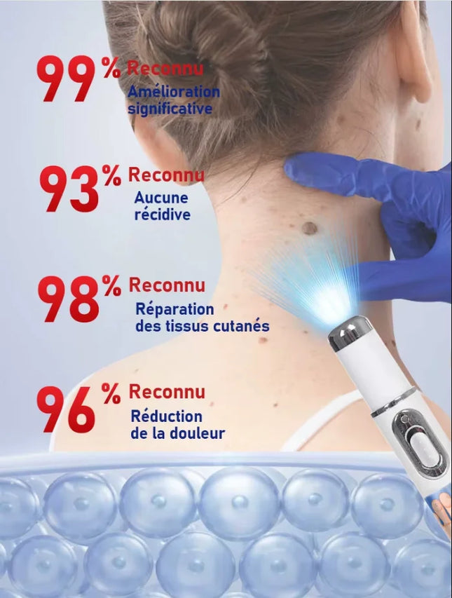 Blue light wart removal tool, more discounts on sets