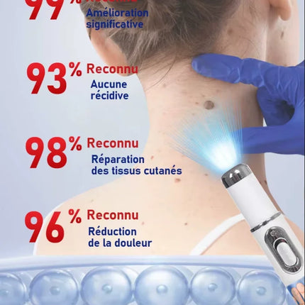 Blue light wart removal tool, more discounts on sets